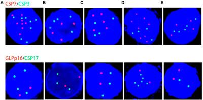 UroVysion™ fluorescence in situ hybridization (FISH) possibly has a high positive rate in carcinoma of non-urothelial lineages